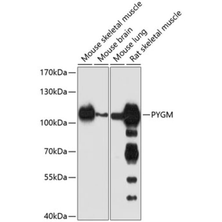 Western Blot - Anti-PYGM Antibody (A16317) - Antibodies.com