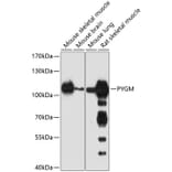 Western Blot - Anti-PYGM Antibody (A16317) - Antibodies.com