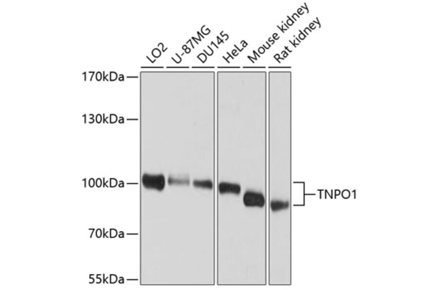 Western Blot - Anti-Transportin 1/MIP Antibody (A16318) - Antibodies.com