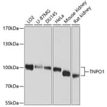 Western Blot - Anti-Transportin 1/MIP Antibody (A16318) - Antibodies.com