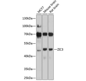Western Blot - Anti-ZIC3 Antibody (A16319) - Antibodies.com