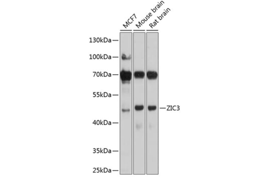 Western Blot - Anti-ZIC3 Antibody (A16319) - Antibodies.com