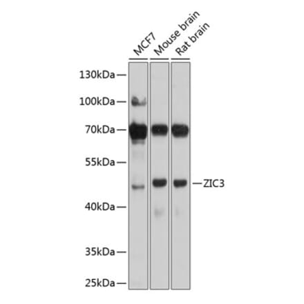 Western Blot - Anti-ZIC3 Antibody (A16319) - Antibodies.com