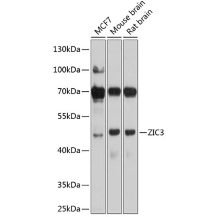 Western Blot - Anti-ZIC3 Antibody (A16319) - Antibodies.com