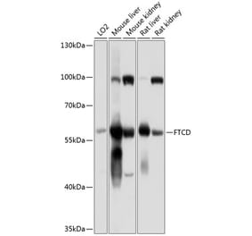 Western Blot - Anti-58K Golgi protein Antibody (A16320) - Antibodies.com