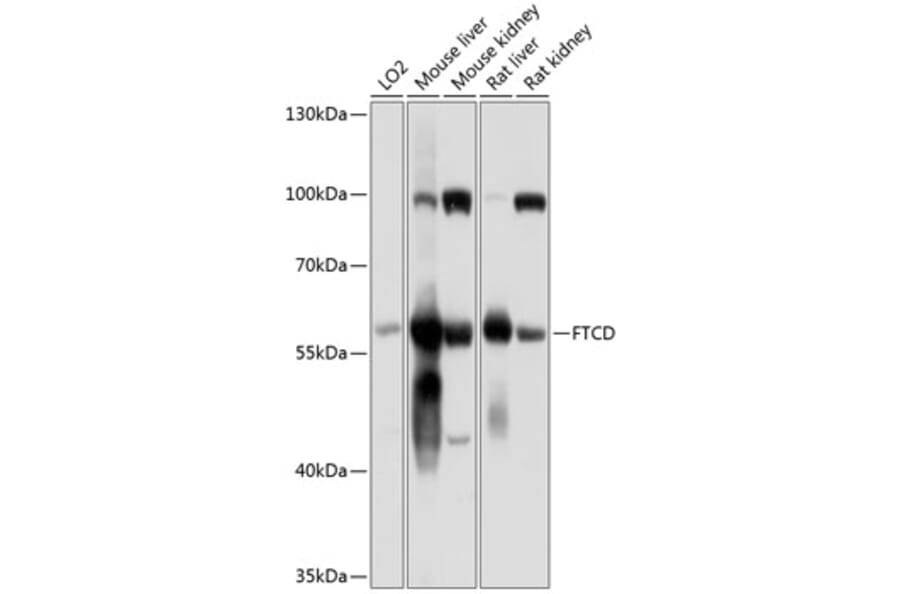 Western Blot - Anti-58K Golgi protein Antibody (A16320) - Antibodies.com