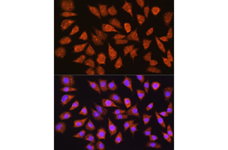 Immunofluorescence - Anti-IMPDH1 Antibody (A16321) - Antibodies.com