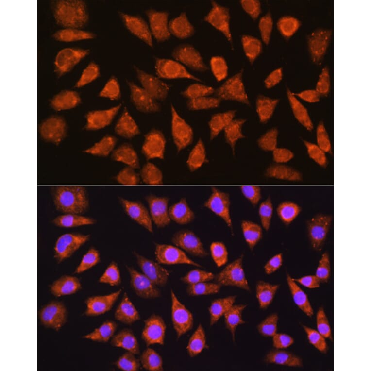 Immunofluorescence - Anti-IMPDH1 Antibody (A16321) - Antibodies.com