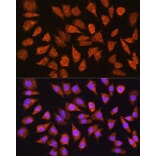 Immunofluorescence - Anti-IMPDH1 Antibody (A16321) - Antibodies.com