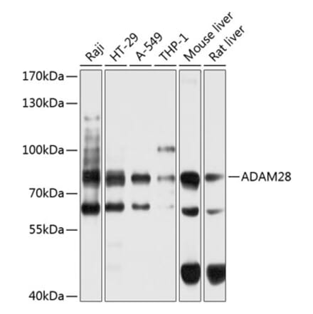 Western Blot - Anti-ADAM28 Antibody (A16323) - Antibodies.com