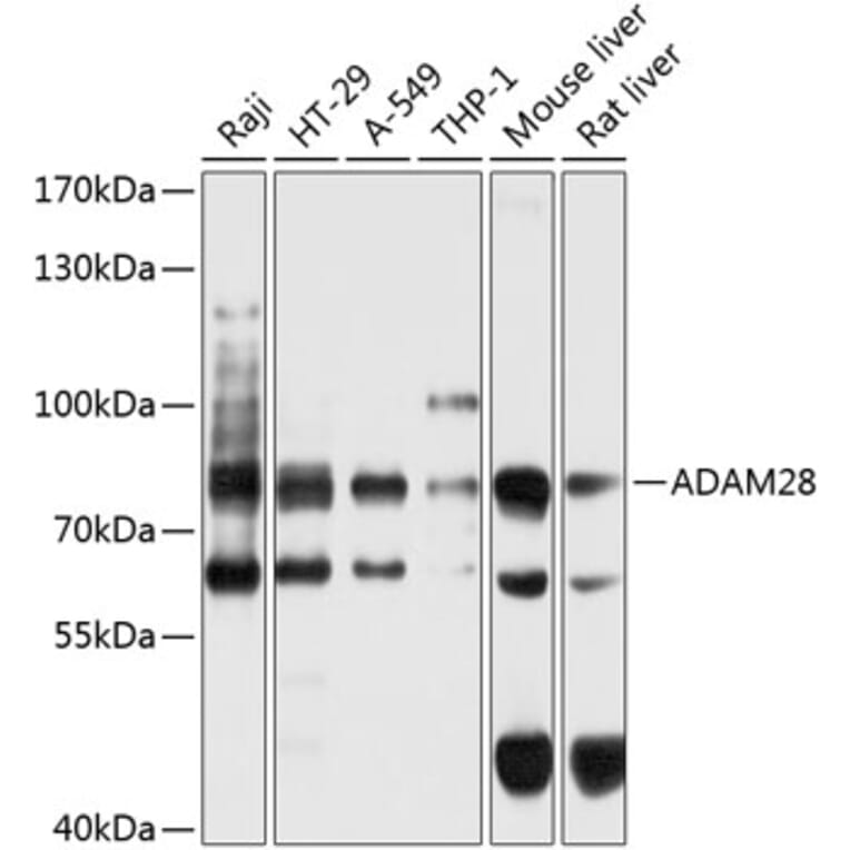 Western Blot - Anti-ADAM28 Antibody (A16323) - Antibodies.com