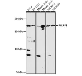 Western Blot - Anti-SCOP Antibody (A16325) - Antibodies.com