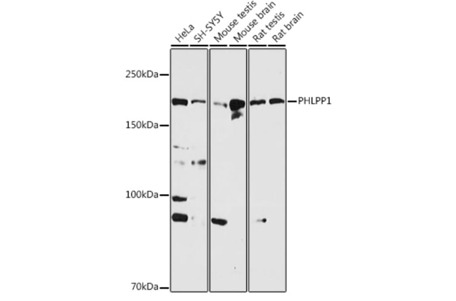 Western Blot - Anti-SCOP Antibody (A16325) - Antibodies.com