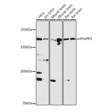 Western Blot - Anti-SCOP Antibody (A16325) - Antibodies.com