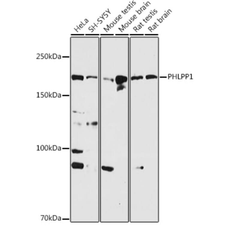 Western Blot - Anti-SCOP Antibody (A16325) - Antibodies.com