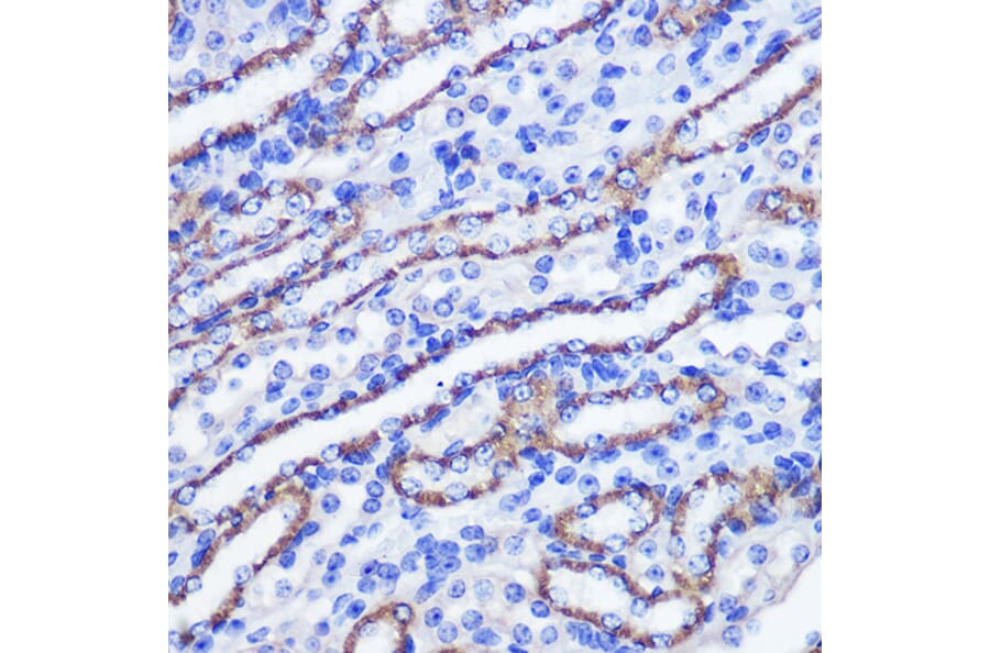 Immunohistochemistry - Anti-SCOP Antibody (A16325) - Antibodies.com