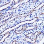 Immunohistochemistry - Anti-SCOP Antibody (A16325) - Antibodies.com