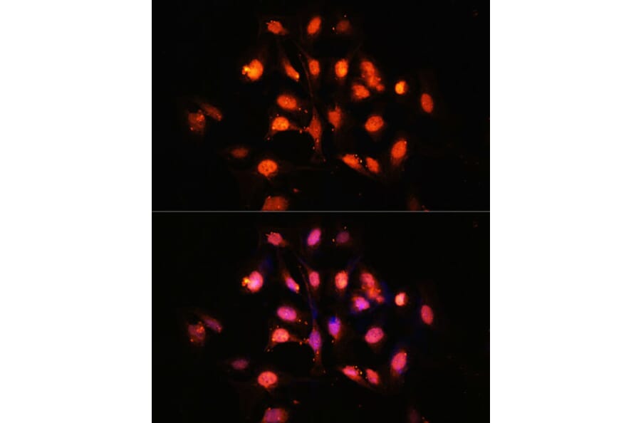 Immunofluorescence - Anti-SCOP Antibody (A16325) - Antibodies.com
