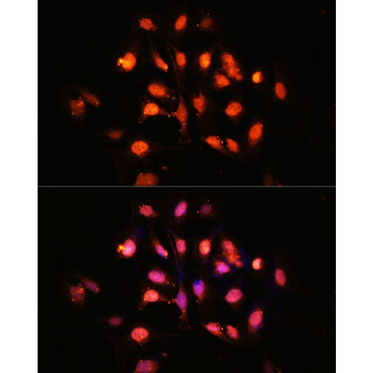 Immunofluorescence - Anti-SCOP Antibody (A16325) - Antibodies.com