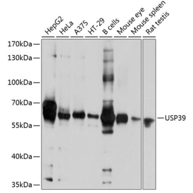 Western Blot - Anti-USP39 Antibody (A16326) - Antibodies.com