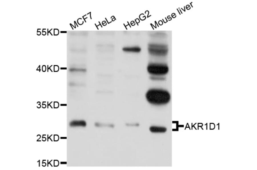 Western Blot - Anti-AKR1D1 Antibody (A9586) - Antibodies.com