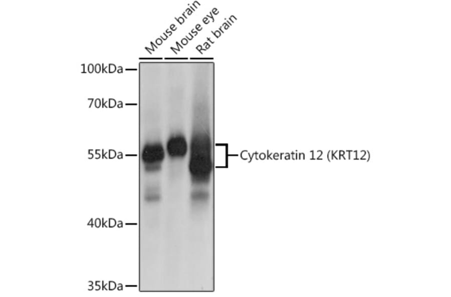 Western Blot - Anti-Keratin 12/K12 Antibody (A16328) - Antibodies.com