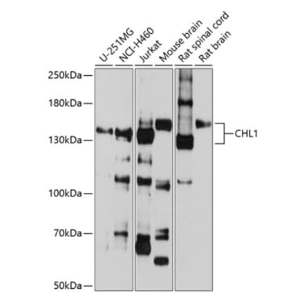 Western Blot - Anti-CHL1 Antibody (A16329) - Antibodies.com