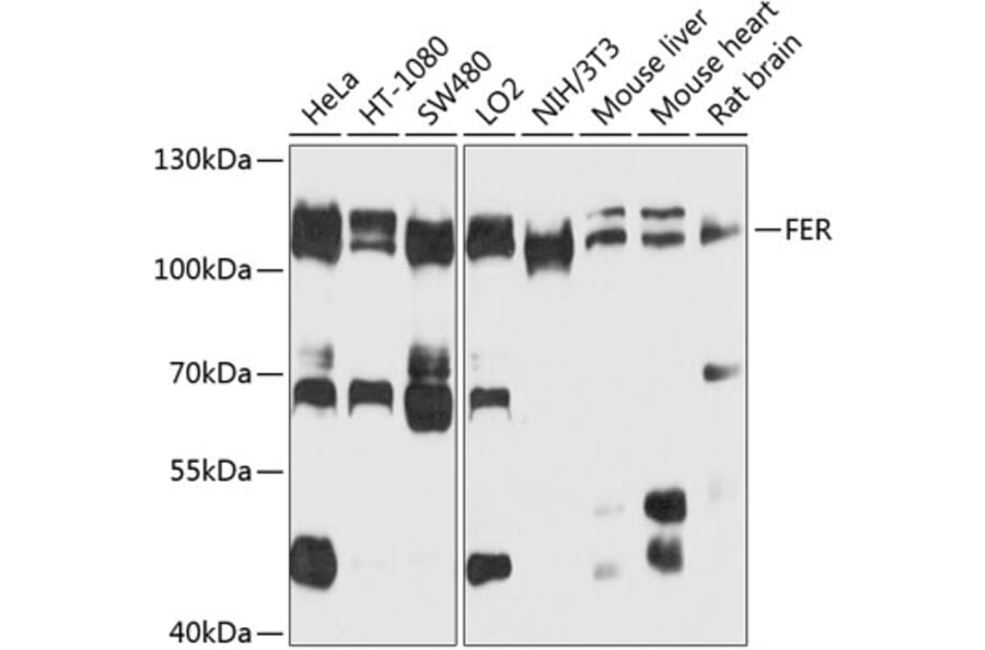 Western Blot - Anti-FER Antibody (A9687) - Antibodies.com