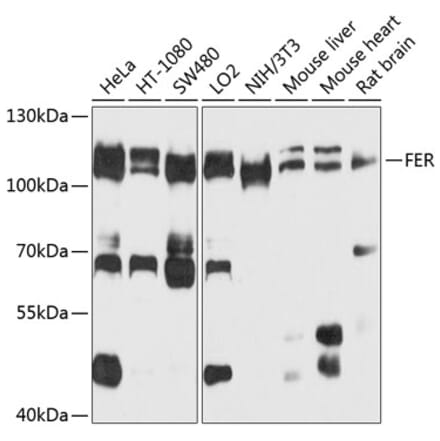 Western Blot - Anti-FER Antibody (A9687) - Antibodies.com