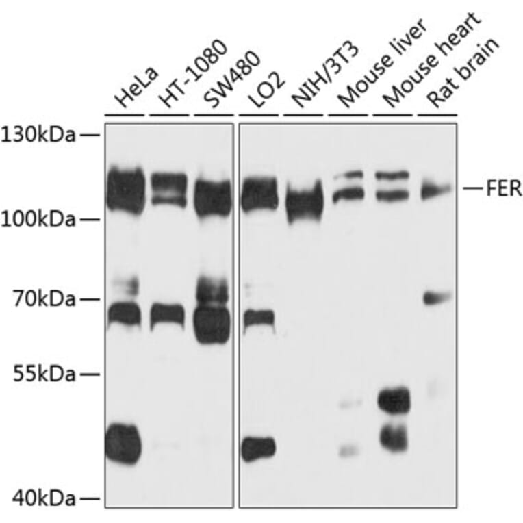 Western Blot - Anti-FER Antibody (A9687) - Antibodies.com