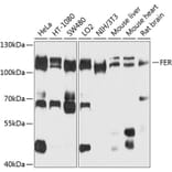 Western Blot - Anti-FER Antibody (A9687) - Antibodies.com