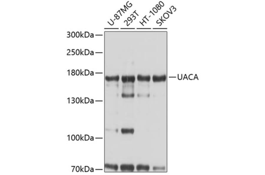Western Blot - Anti-UACA Antibody (A9713) - Antibodies.com