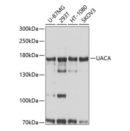 Western Blot - Anti-UACA Antibody (A9713) - Antibodies.com