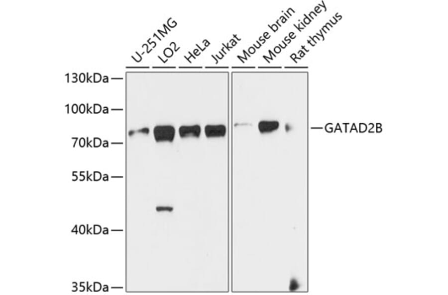 Western Blot - Anti-GATAD2B Antibody (A16332) - Antibodies.com