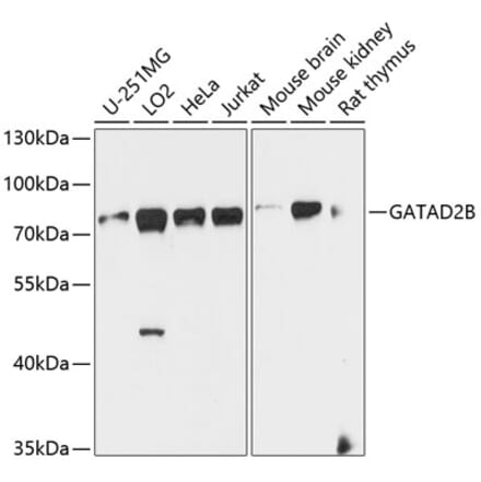 Western Blot - Anti-GATAD2B Antibody (A16332) - Antibodies.com