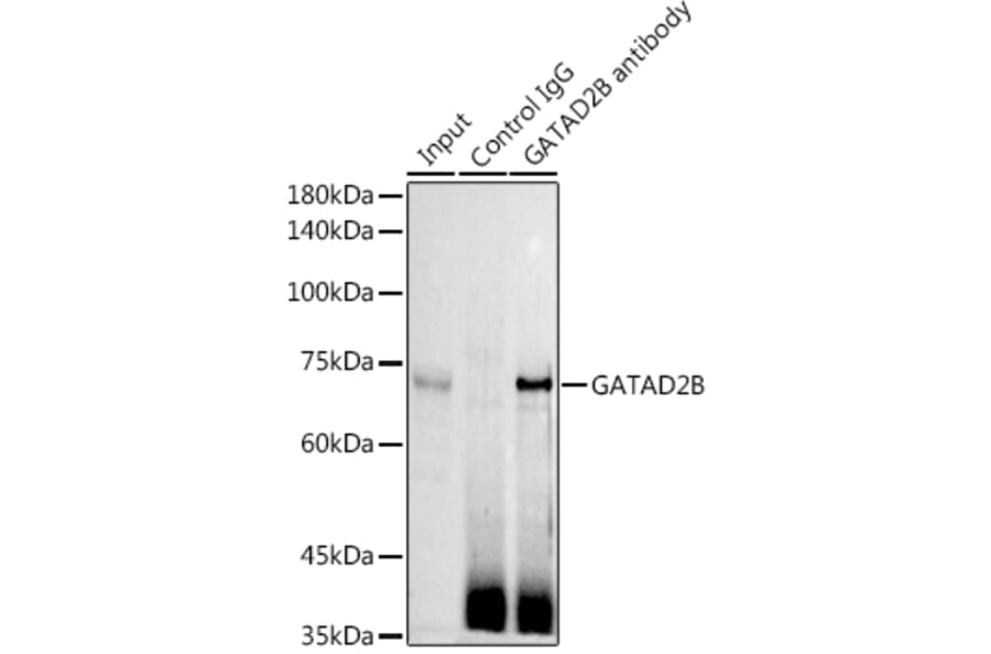 Western Blot - Anti-GATAD2B Antibody (A16332) - Antibodies.com