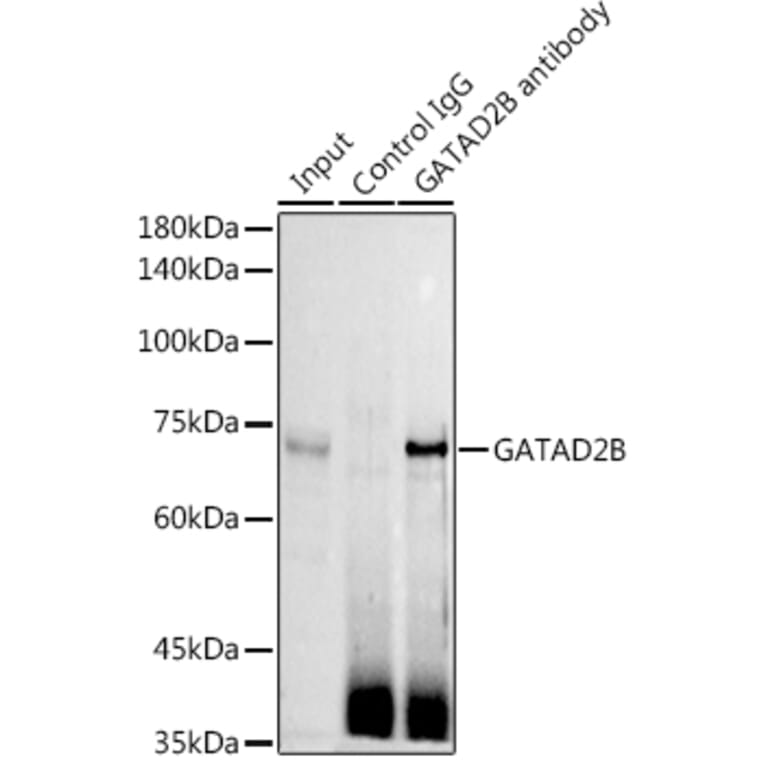 Western Blot - Anti-GATAD2B Antibody (A16332) - Antibodies.com