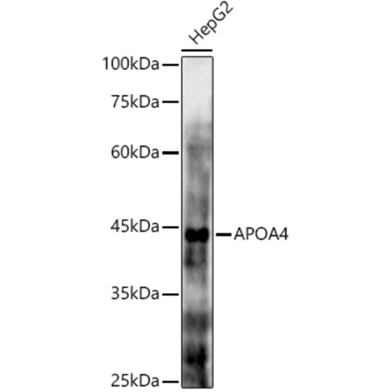 Western Blot - Anti-APOA4/Apo-AIV Antibody (A16333) - Antibodies.com