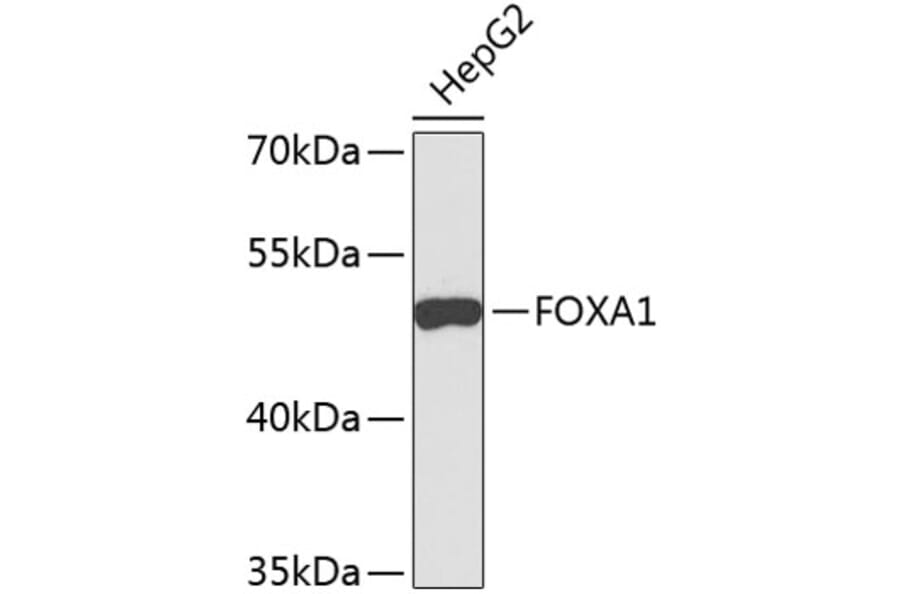 Western Blot - Anti-FOXA1 Antibody (A9793) - Antibodies.com