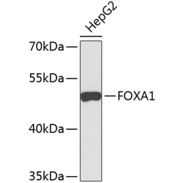 Western Blot - Anti-FOXA1 Antibody (A9793) - Antibodies.com
