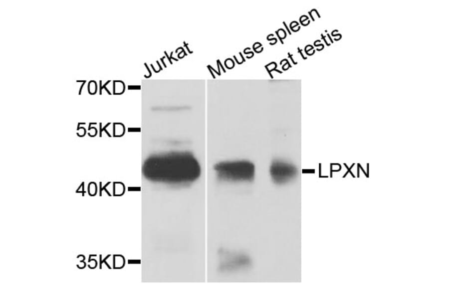 Western Blot - Anti-LPXN Antibody (A9803) - Antibodies.com