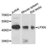 Western Blot - Anti-LPXN Antibody (A9803) - Antibodies.com