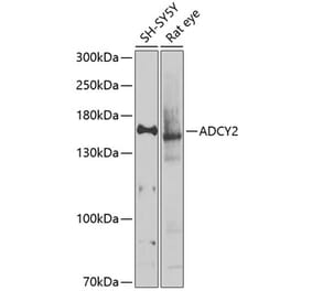 Western Blot - Anti-ADCY2 Antibody (A16336) - Antibodies.com