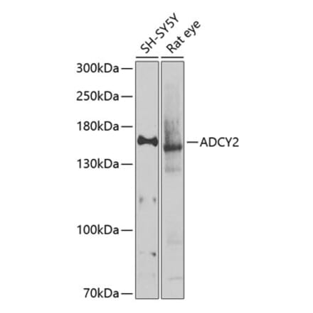 Western Blot - Anti-ADCY2 Antibody (A16336) - Antibodies.com