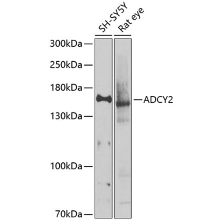 Western Blot - Anti-ADCY2 Antibody (A16336) - Antibodies.com