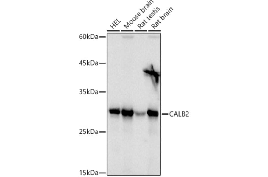 Western Blot - Anti-Calretinin Antibody (A16338) - Antibodies.com