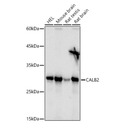 Western Blot - Anti-Calretinin Antibody (A16338) - Antibodies.com