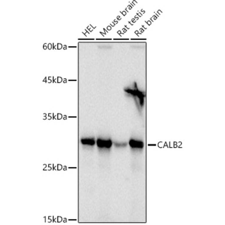 Western Blot - Anti-Calretinin Antibody (A16338) - Antibodies.com