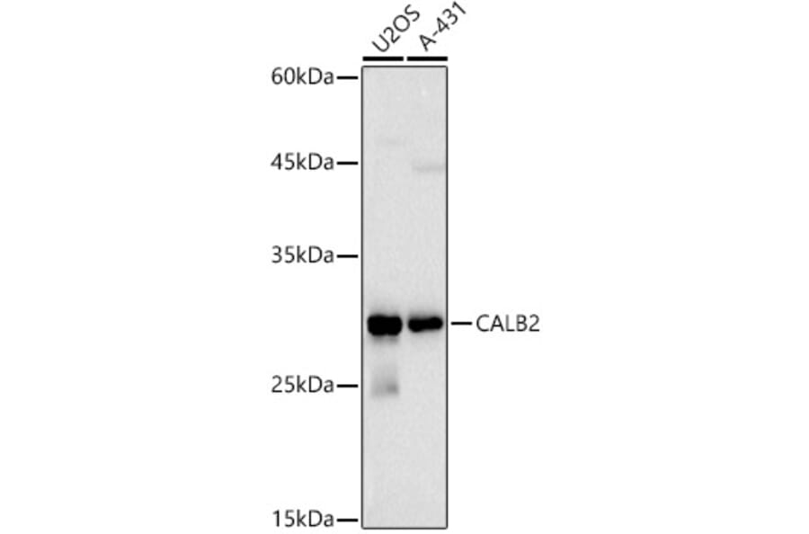Western Blot - Anti-Calretinin Antibody (A16338) - Antibodies.com