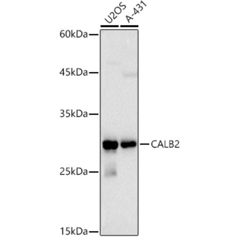 Western Blot - Anti-Calretinin Antibody (A16338) - Antibodies.com